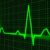 pulse trace, healthcare medicine, heartbeat-163708.jpg